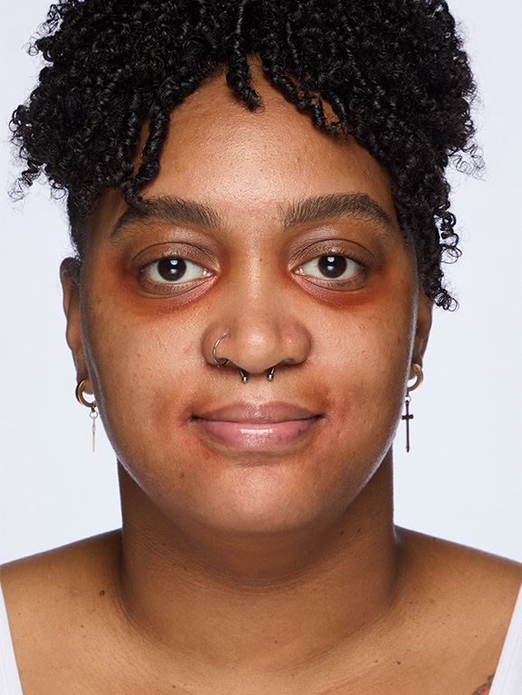 Despu&eacute;s de la aplicaci&oacute;n del corrector